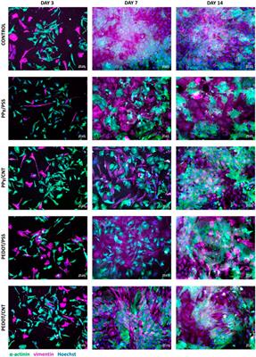 Carbon nanotube nanocomposite scaffolds: advances in fabrication and applications for tissue regeneration and cancer therapy